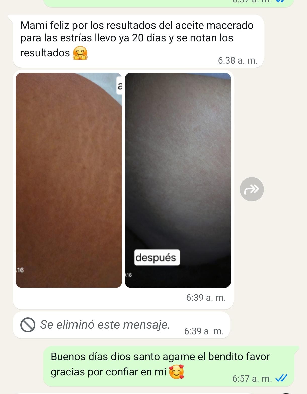 Aceite natural anti estrías